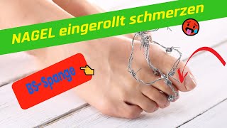 Nagel eingerollt und schmerzt Klebespange Tamponade Mull entlasten [upl. by Gabler678]