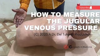 How To Measure The JVP  OSCE Guide [upl. by Jenn]