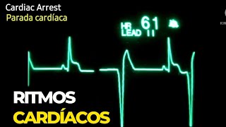 ECG EKG Ritmos cardíacos letales sinusal taquicardia bradicardia fibrilação parada cardíaca [upl. by Leeann126]