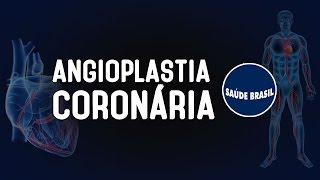 ANGIOPLASTIA CORONÁRIA  SÉRIE SAÚDE BRASIL [upl. by Icyaj580]