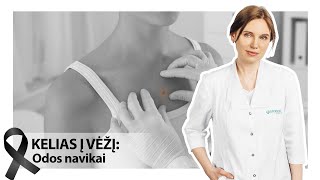 KELIAS Į VĖŽĮ Odos navikai  Gydytoja onkodermatovenerologė med m dr Silvija Kontautienė [upl. by Chaim248]