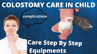 Colostomy Care in Child  Colostomy Definition Types Indications  Colostomy Care Step By Step [upl. by Thurlow383]