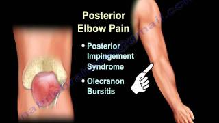 ELBOW PAIN  COMMON CAUSES  Everything You Need To Know  Dr Nabil Ebraheim [upl. by Ayanet]