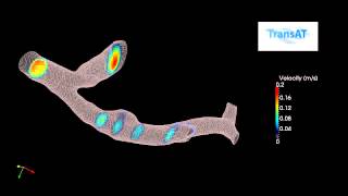 Numerical Simulation of Blood Flow in an Artery [upl. by Arturo]