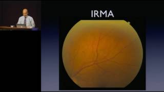 Diabetic Retinopathy [upl. by Lubba889]