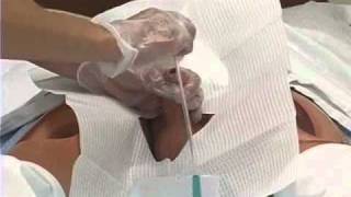 Foley Catheter Skills Demonstration 2 of 3 [upl. by Berny]