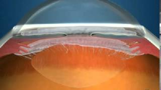 How Fluid Circulates in the Eye [upl. by Namhcan654]