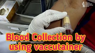 Blood collection by using vaccutainer methodclosed system of blood collection [upl. by Leirbma]