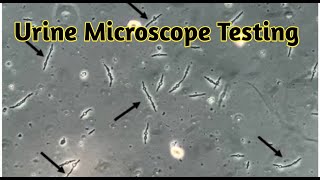 urine sediment microscopy  urine microscopy procedure [upl. by Nolad283]