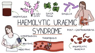 Haemolytic Uraemic Syndrome [upl. by Miguelita352]