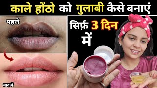 काले होंठो को गुलाबी कैसे बनाए Dark Lips Treatment  Dark Dry Pigmented Lips से कैसे छुटकारा पाएं। [upl. by Nirik543]