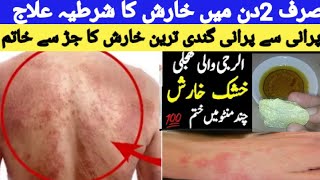 Purani Se Purani Kharish Ka Dasi Ilaj Allergy Ka Ilaj Kharish Ka Ilaj In Urdu Khujli ka Gharelu Ilaj [upl. by Aihsad]