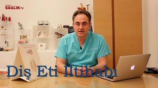 Diş Eti İltihabı  Prof Dr Bülent Kurtiş [upl. by Harleigh]