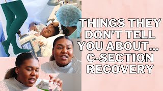 C SECTION RECOVERY  THINGS THEY DONT TELL YOU [upl. by Eissert299]