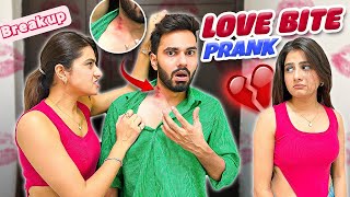 Hickey Prank Gone Wrong 😱 Ayushyadav [upl. by Deerdre]