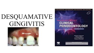 Desquamative Gingivitis lecture from Carranza [upl. by Navap]