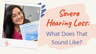 Hearing Speech With A Severe Hearing Loss  Severe Hearing Loss Simulation [upl. by Luiza886]