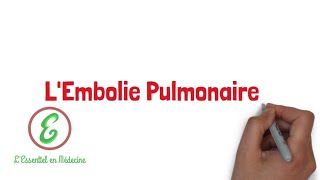 LEssentiel sur lEmbolie Pulmonaire [upl. by Chuah]