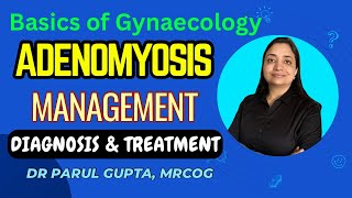 Management of Adenomyosis  Investigations amp Treatment  Part2 [upl. by Coriss]