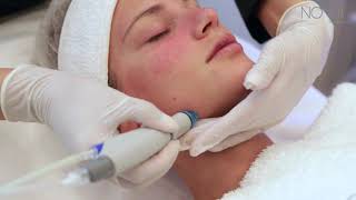 HydraFacial at Nova Clinic Dubai  Award Winning Facial Treatment [upl. by Kant285]