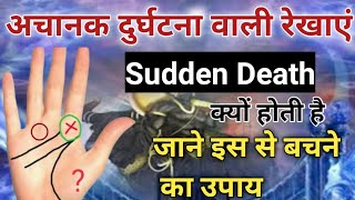 अचानक दुर्घटना वाली रेखाएंsudden deathMystery of Hand Lines अचानक दुर्घटना का सच [upl. by Drew]