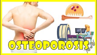 Osteoporosis  Causes Pathogenesis Signs amp Symptoms And Diagnosis [upl. by Farrar]