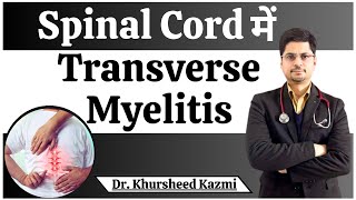 Spinal cord में Transverse Myelitis  Transverse Myelitis Treatment in Delhi  Dr Khursheed Kazmi [upl. by Anabahs]