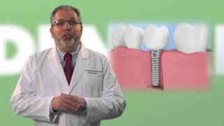 What You Need to Know About Tooth Grinding [upl. by Mila]