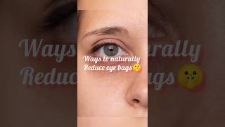 Ways to reduce eye bags naturally🤫 eyebag skincare skincaretips theananyasgrace shorts viral [upl. by Adnuhsor934]