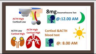 Tumeurs LAdénome Hypophysaire Acromégalie ou adénome somatotrope Prolactine [upl. by Patman]