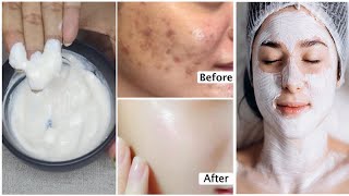 Best Homemade Facial for Skin Whitening Natural Glow amp Brightening Remedy [upl. by Attezi]