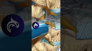 See how a TLIF relieves back pain and restores spinal stability with a 3D Animation [upl. by Barnie]