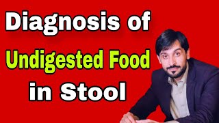 Undigested Food in Stool Causes amp Diagnosis  MLT Hub with kamran [upl. by Clement]