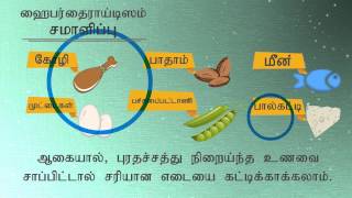 Hyperthyroidism Managing Hyperthyroidism Tamil [upl. by Enileqcaj171]