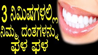 Natural Ways to Whiten Teeth at Home  3 ನಿಮಿಷಗಳಲ್ಲಿ ನಿಮ್ಮ ದಂತಗಳನ್ನು ಫಳ ಫಳ  YOYO TV Kannada Health [upl. by Koloski]