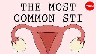 The most common STI in the world  Emma Bryce [upl. by Hendricks]