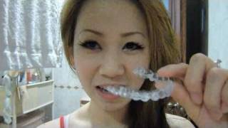 Dblchin with Better Straighter TeethInvisalign attachments [upl. by Vasya]