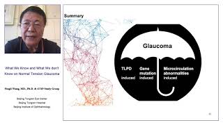 Different forms of glaucoma – are the approaches to hypotensive treatment similar Ningli Wang [upl. by Schargel]