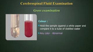 Cerebrospinal Fluid Examination CSF [upl. by Ecnerwaled]