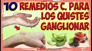 10 Remedios Caseros para Quistes Ganglionar  Como Aliviar Quistes Ganglio [upl. by Whit]