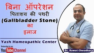 पित्ताशय की पथरी Gallbladder Stone का बिना ऑपरेशन के इलाज  Yash Homeopathic Center [upl. by Joo279]