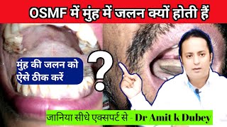 OSMF में मुंह में जलन क्यों होती हैं। Redused Mouth Opening Treatment [upl. by Silverts818]