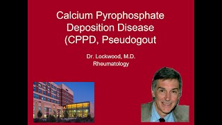 10 Calcium Pyrophosphate Deposition Disease Pseudogout [upl. by Airdnas951]