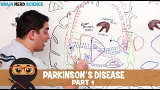 Parkinsons Disease  Clinical Presentation  Part 1 [upl. by Minne]