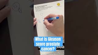 Understanding Gleason score Prostate cancer [upl. by Enetsirk615]