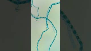 🤖 Spirogyra Conjugación bajo el microscopio 🤖 🔬 [upl. by Elolcin]