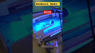 Jaundiced Newborn Baby NICU babydocter newbornbaby video cute baby doctor cutebaby borneba [upl. by Pubilis351]