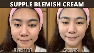 KLAIRS Illuminating Supple Blemish Cream  ACTUAL TRIAL [upl. by Rosemarie]