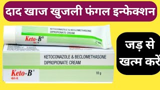 Keto B Cream Uses  दाद खाज खुजली फंगल इन्फेक्शन को जड़ से खत्म करे [upl. by Eelasor]