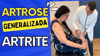 Dor no Joelho mesmo após Cirurgia Tornozelos Inchados  cirurgiadojoelho joelho tornozelo [upl. by Algie]